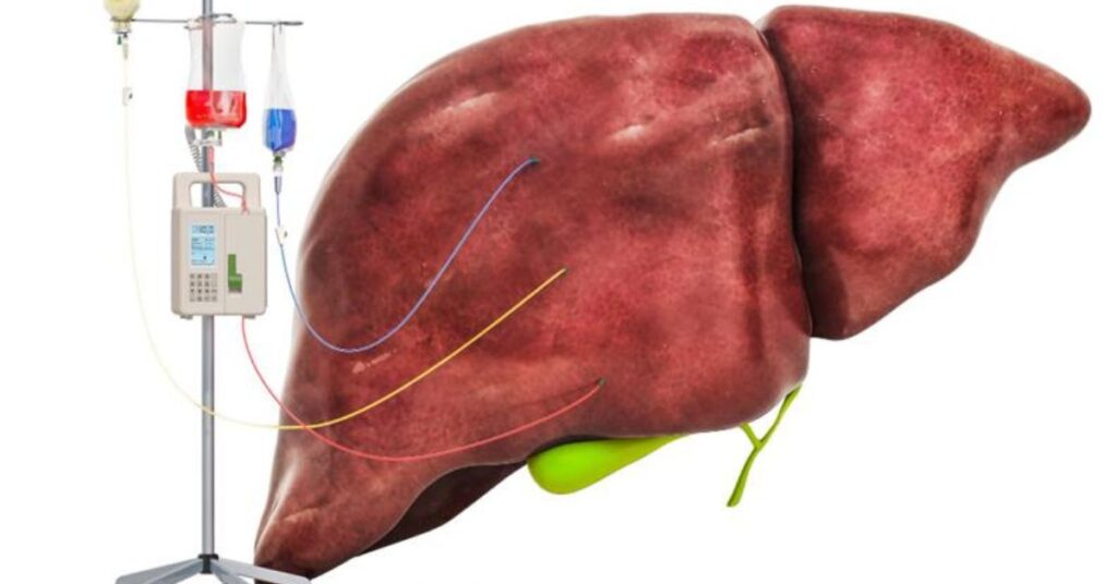 liver transplant in indore